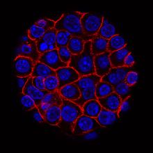 Cancer Cells