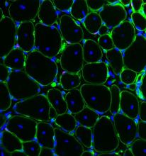 Muscle Stem Cells